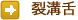 裂溝舌